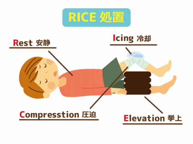RICE処置のイラスト